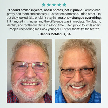 😊Final Day Deal: 70% Discount!🦷DarkFairy™ Custom-Fit Functional Full Dentures for Greater Self-Assurance