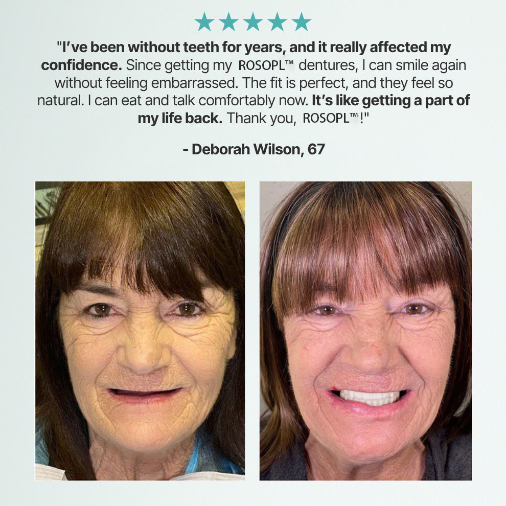 😊Final Day Deal: 70% Discount!🦷DarkFairy™ Custom-Fit Functional Full Dentures for Greater Self-Assurance